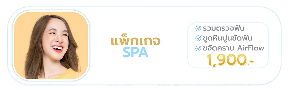 โปรโมชั่นขูดหินปูน ขัดฟัน