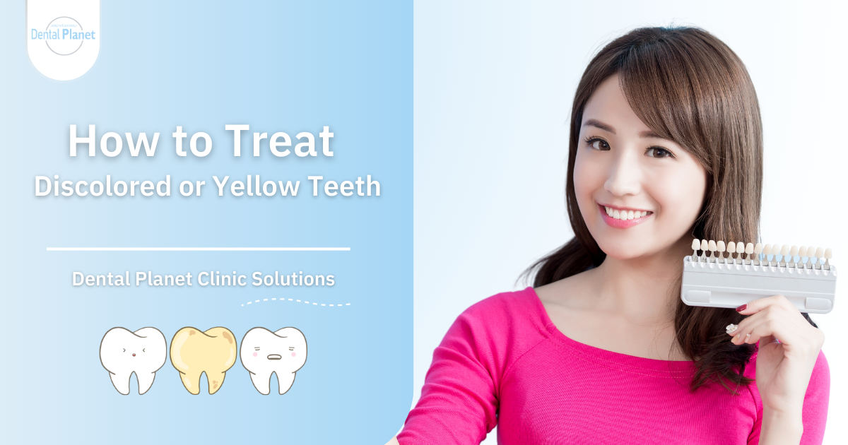 Treat discolored teeth