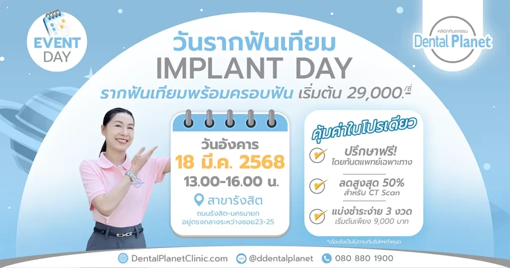 โปรโมชั่นรากเทียม รังสิต