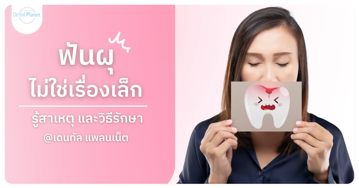 ฟันผุ