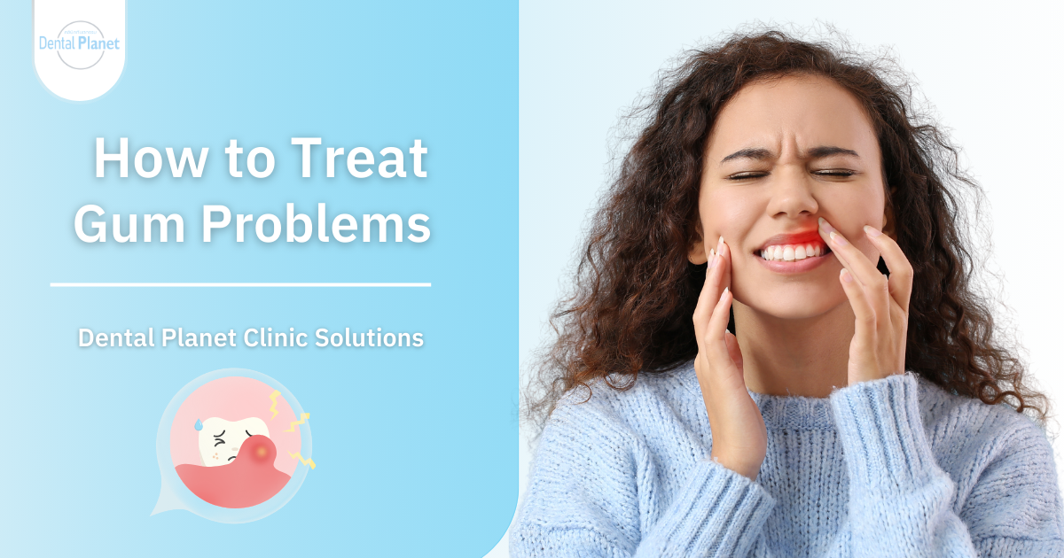 Gingivitis treatments