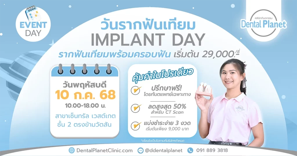 โปรโมชั่นรากเทียม เวสต์เกต