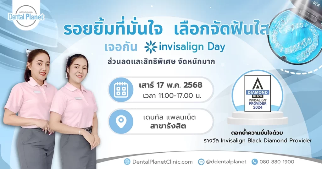 โปรโมชั่นจัดฟันใส รังสิต