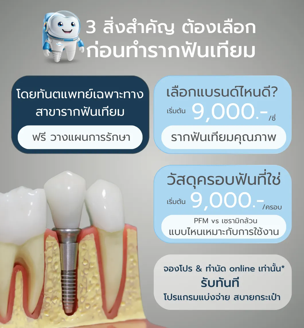 ราคา รากฟันเทียม