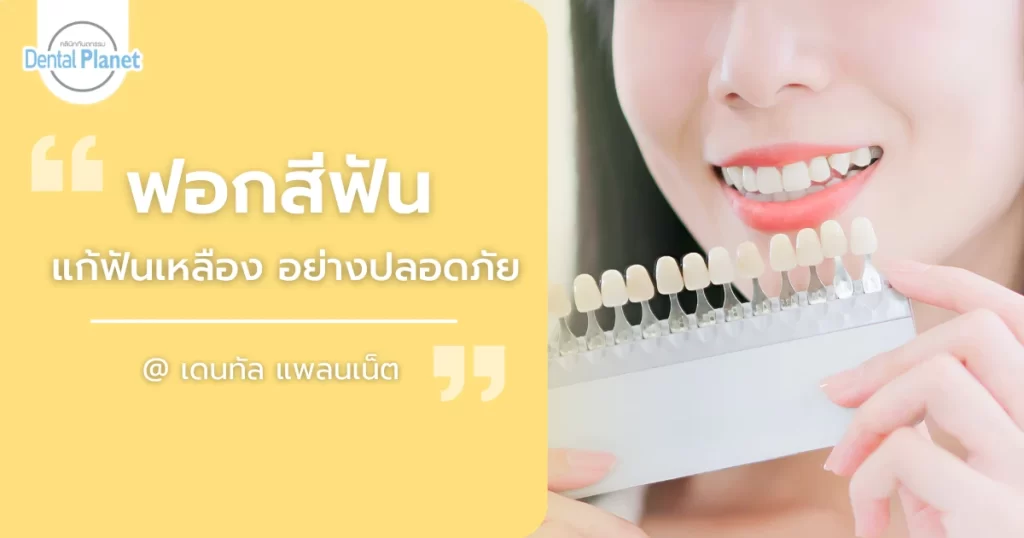 ฟอกสีฟัน