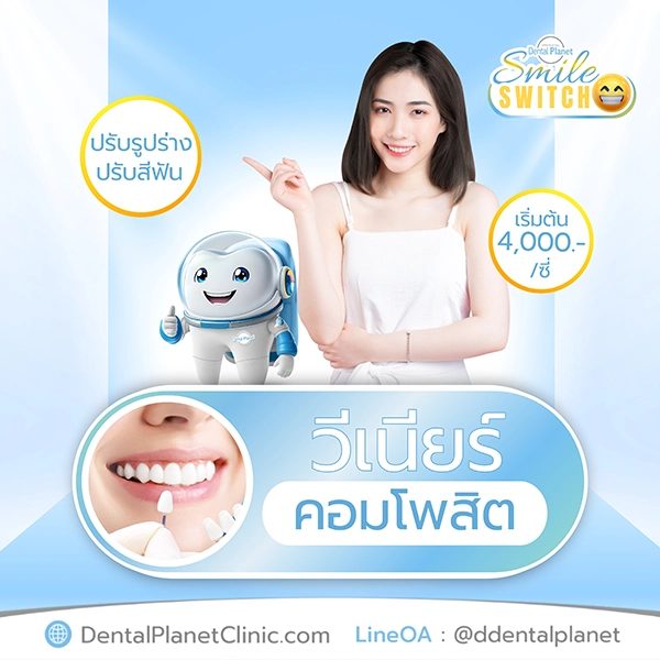 ทำวีเนียร์กี่บาท