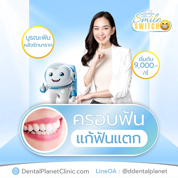 ครอบฟันราคา