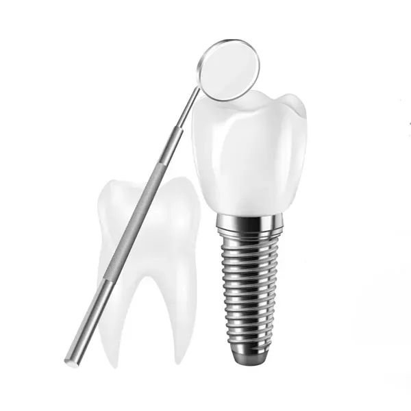 Dental Implants