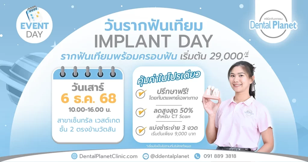 โปรโมชั่นรากเทียม เวสต์เกต