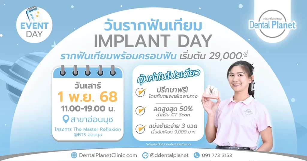 โปรโมชั่นรากเทียม อ่อนนุช