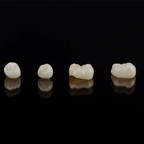Ceramic Crown