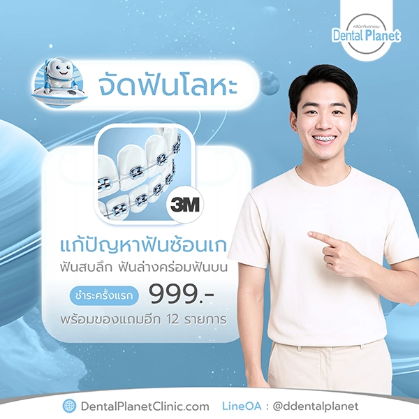 โปรโมชั่นจัดฟันโลหะ