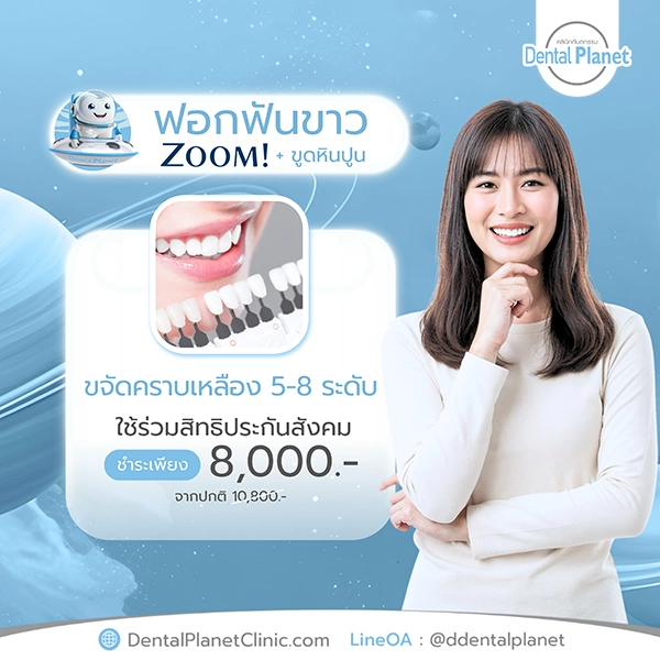 โปรฟอกฟันขาว ขูดหินปูน