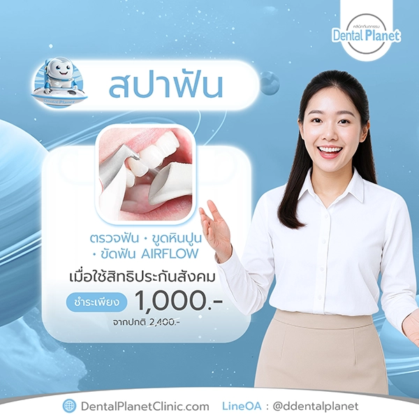 โปรโมชั่นสปาฟัน ขูดหินปูน