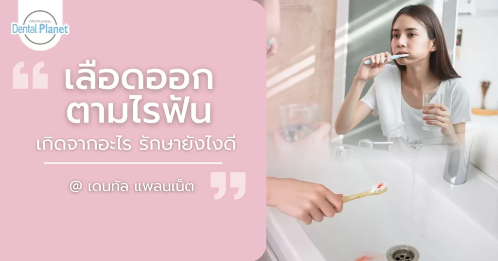 เลือดออกตามไรฟัน