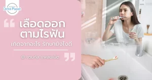 เลือดออกตามไรฟัน