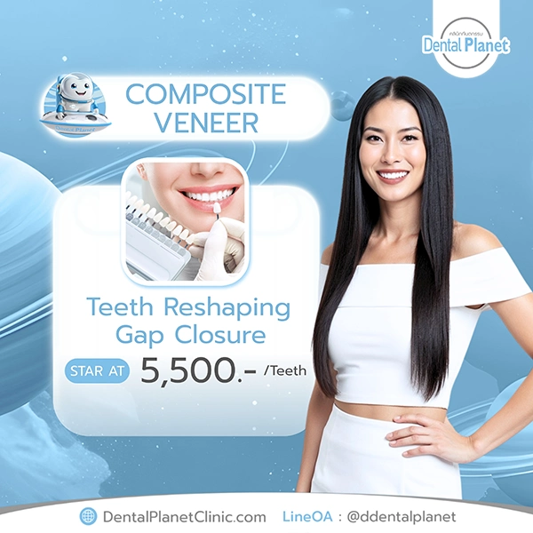 promotion dental veneer