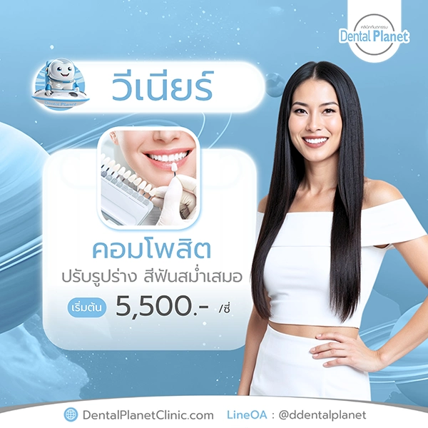 ทำวีเนียร์กี่บาท