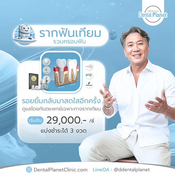 ราคา รากฟันเทียม