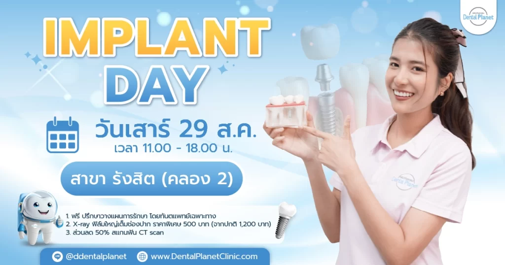 โปรโมชั่นรากเทียม รังสิต