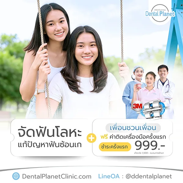 โปรโมชั่นจัดฟันโลหะ