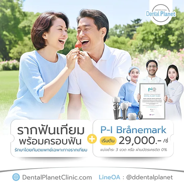 ราคา รากฟันเทียม 2569