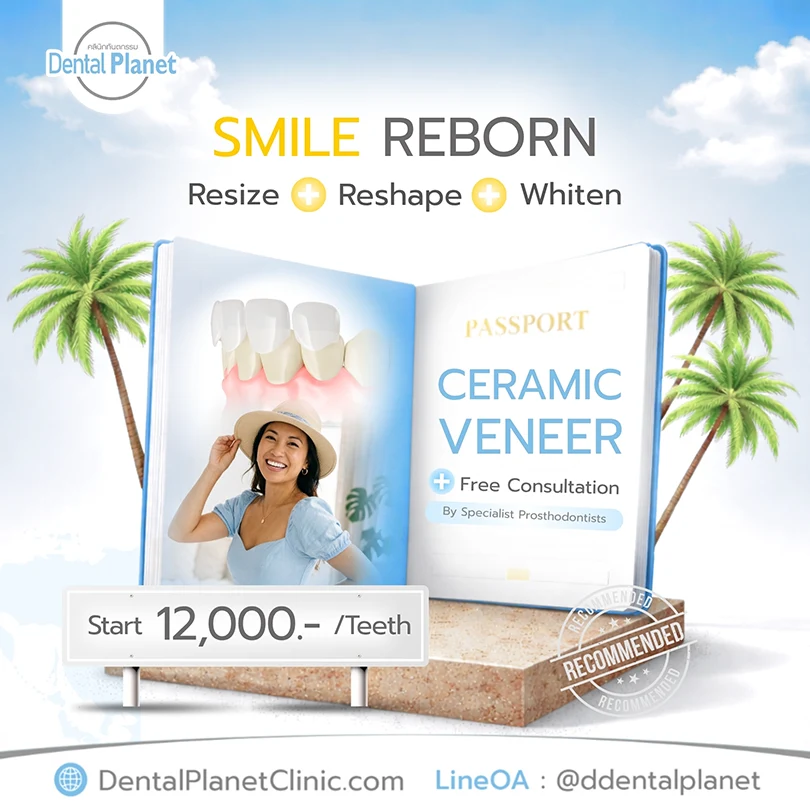 Promotion Dental Veneers