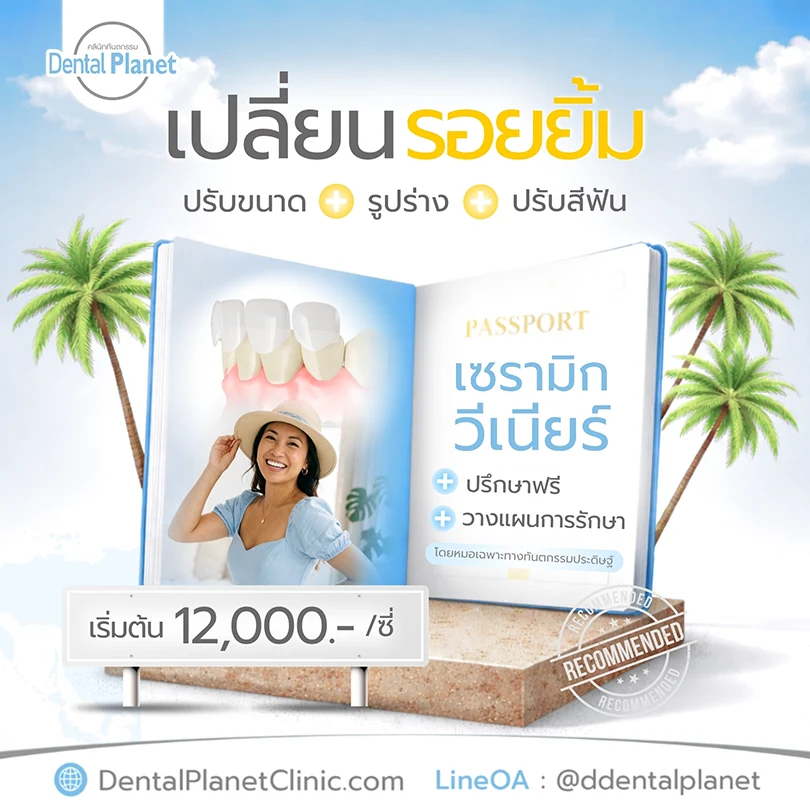 โปรโมชั่นวีเนียร์ ฟันสวย