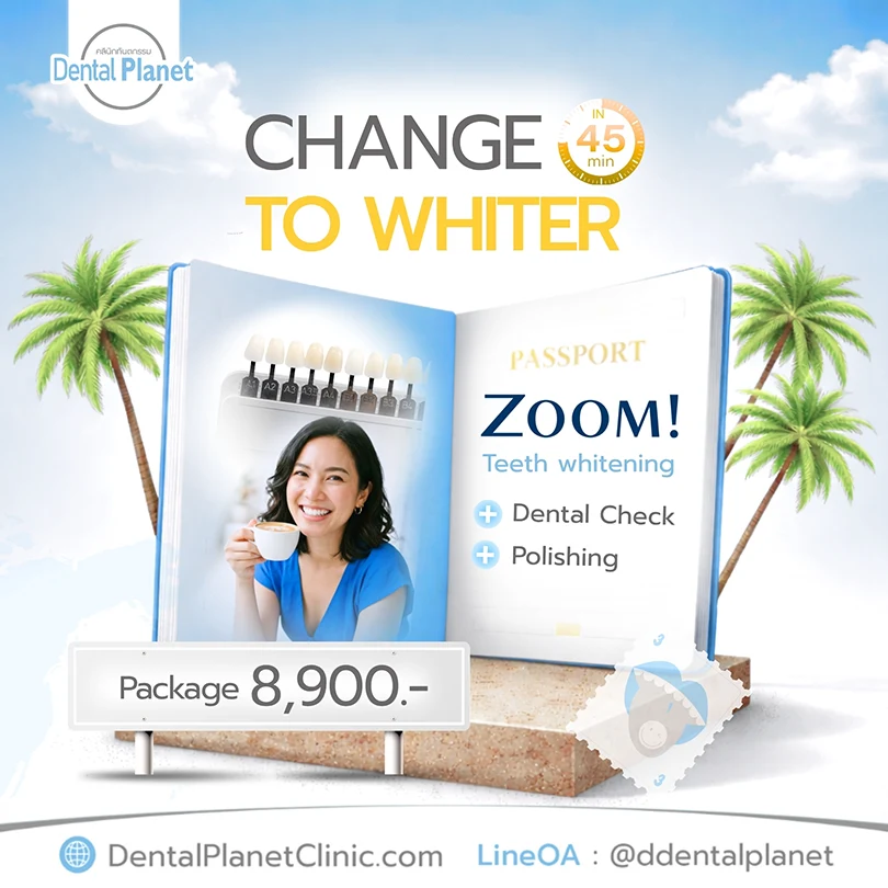 promotion Whitening Teeth