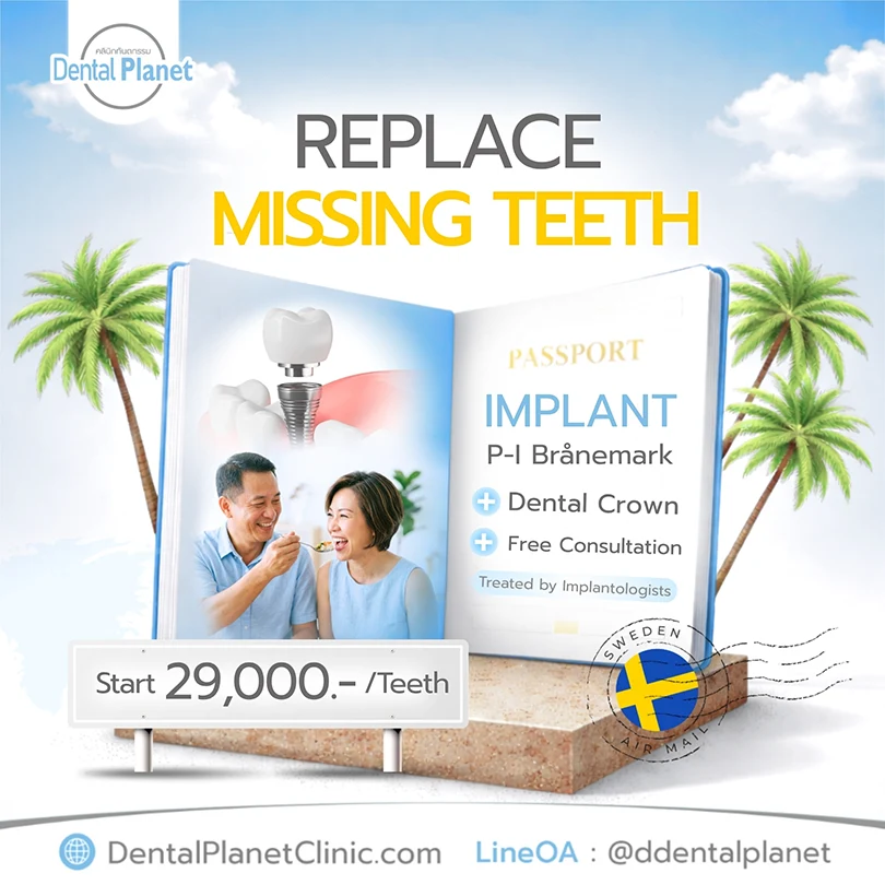 promotion dental implant