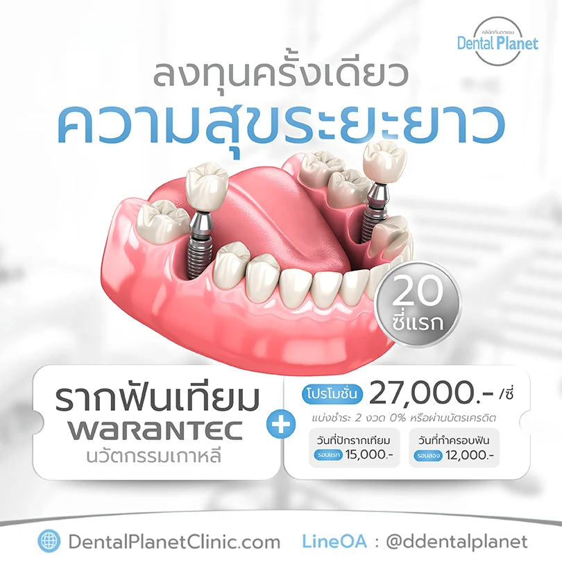 ราคารากเทียมเกาหลี Warantec