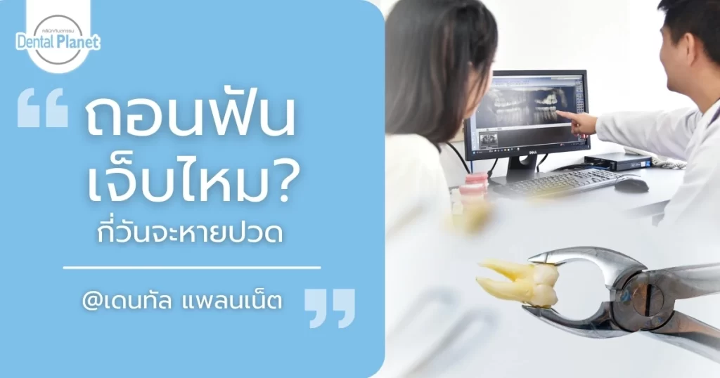 ถอนฟันเจ็บไหม หลังถอนฟันกี่วันหายปวด