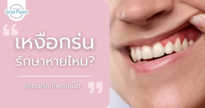 เหงือกร่น รักษาหายไหม