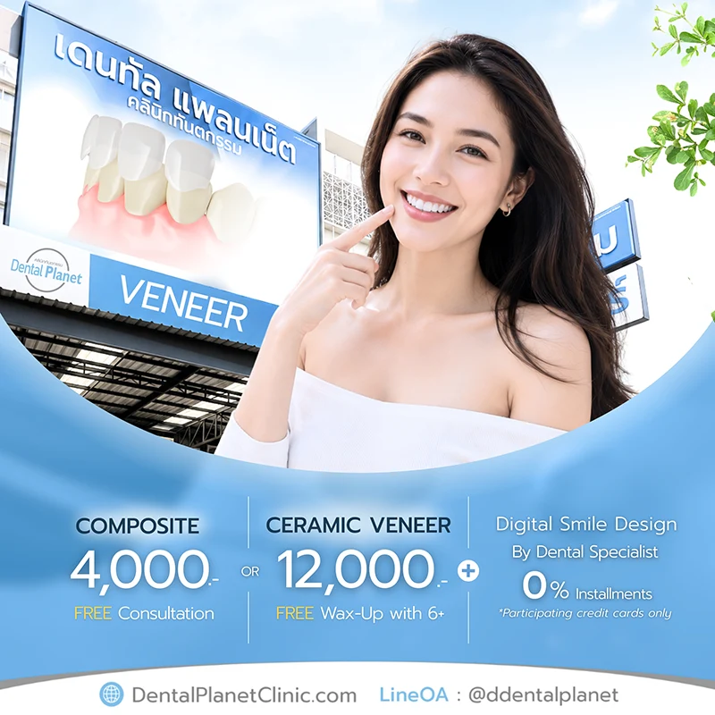 Promotion Dental Veneers