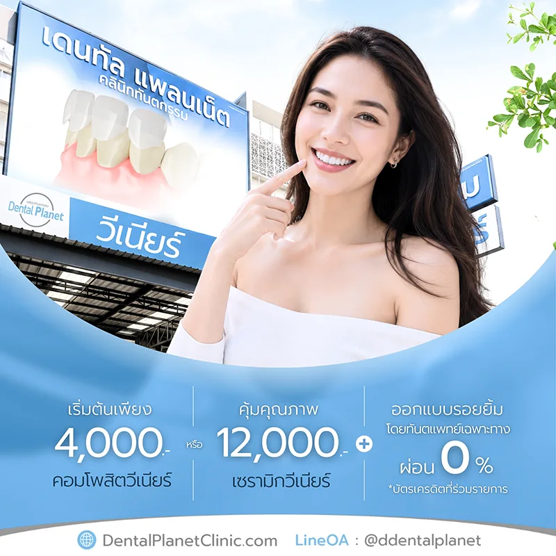 โปรโมชั่นวีเนียร์ ฟันสวย