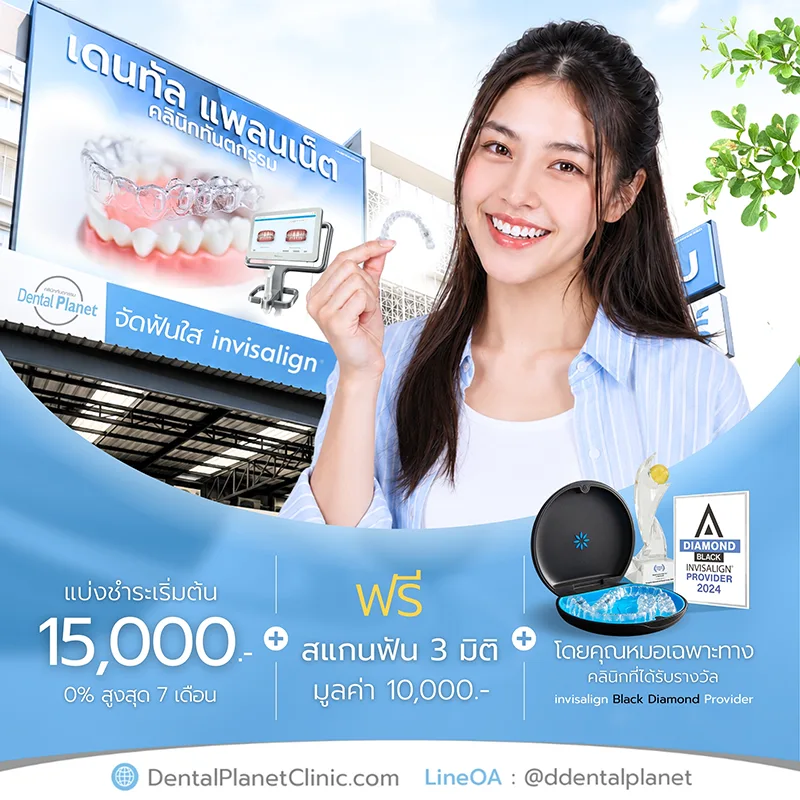 โปรโมชั่นจัดฟันใส Invisalign