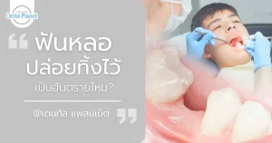 โทษของฟันหลอ เมื่อปล่อยทิ้งไว้นาน