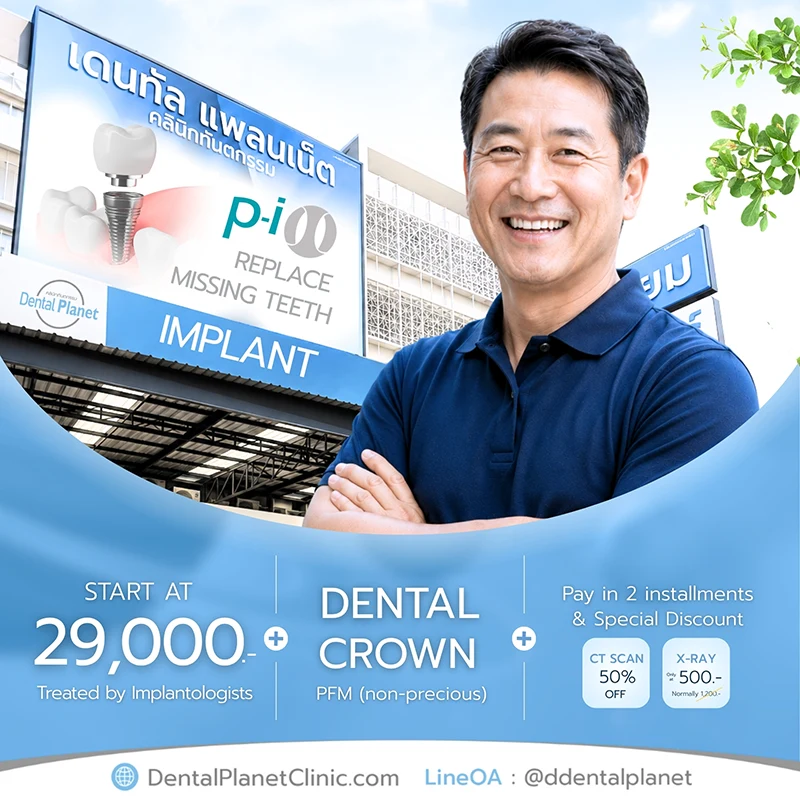 promotion dental implant