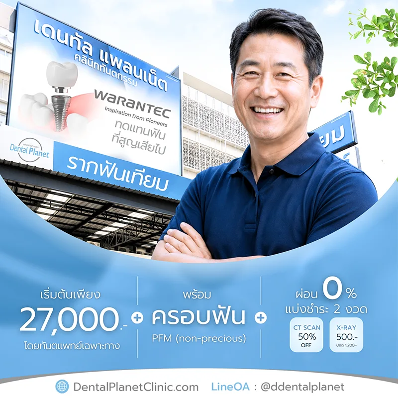 โปรโมชั่นทำรากเทียม ทำฟัน ใกล้บ้าน