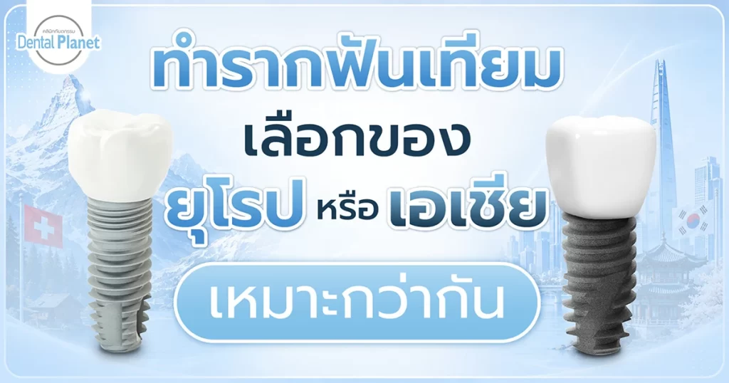 ราคารากฟันเทียม