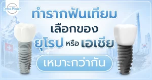 ราคารากฟันเทียม