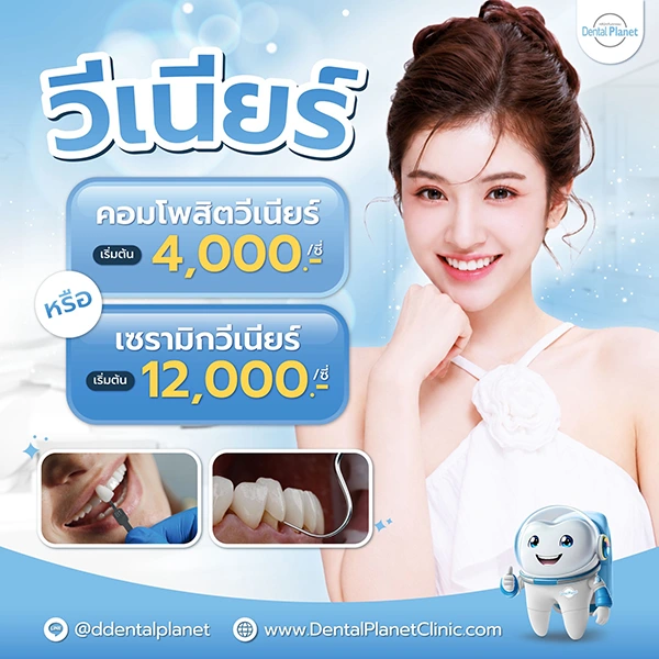 โปรโมชั่นวีเนียร์ ฟันสวย