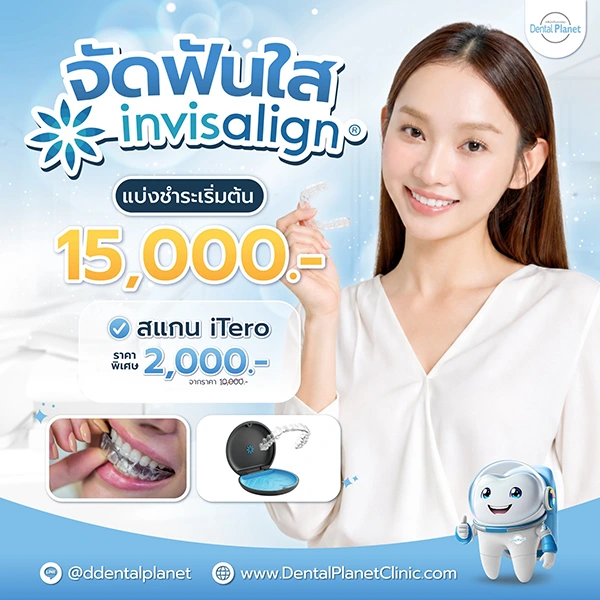 โปรโมชั่นจัดฟันใส Invisalign