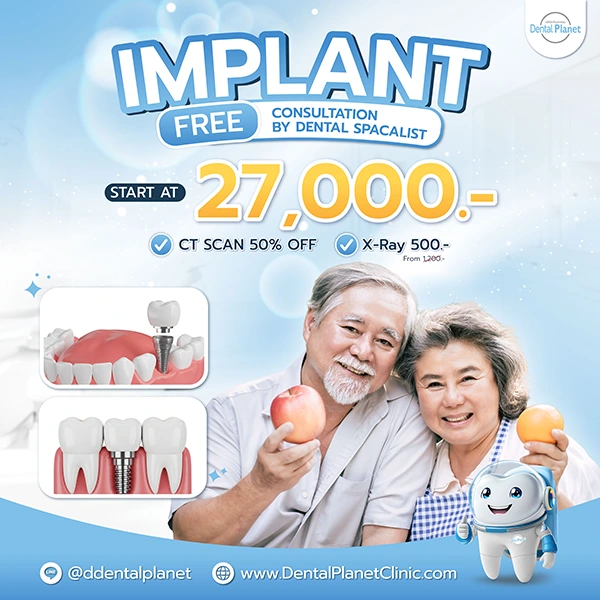 promotion dental implant
