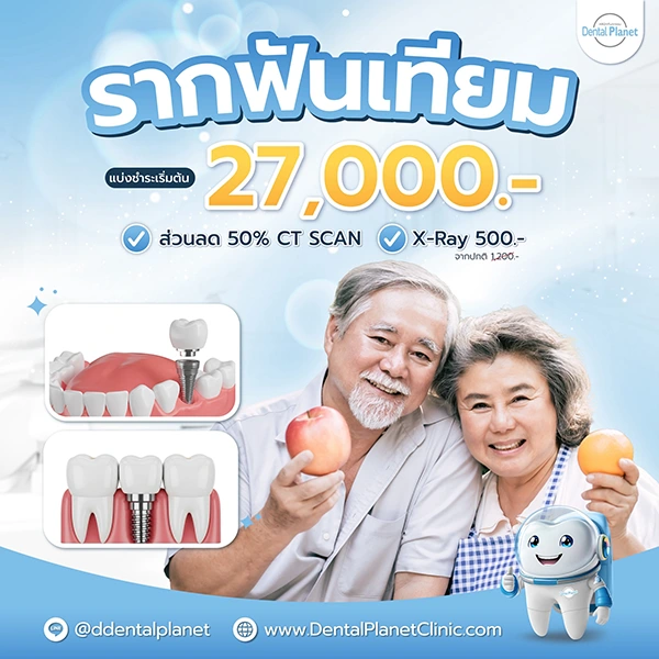 โปรโมชั่นทำรากเทียม ทำฟัน ใกล้บ้าน